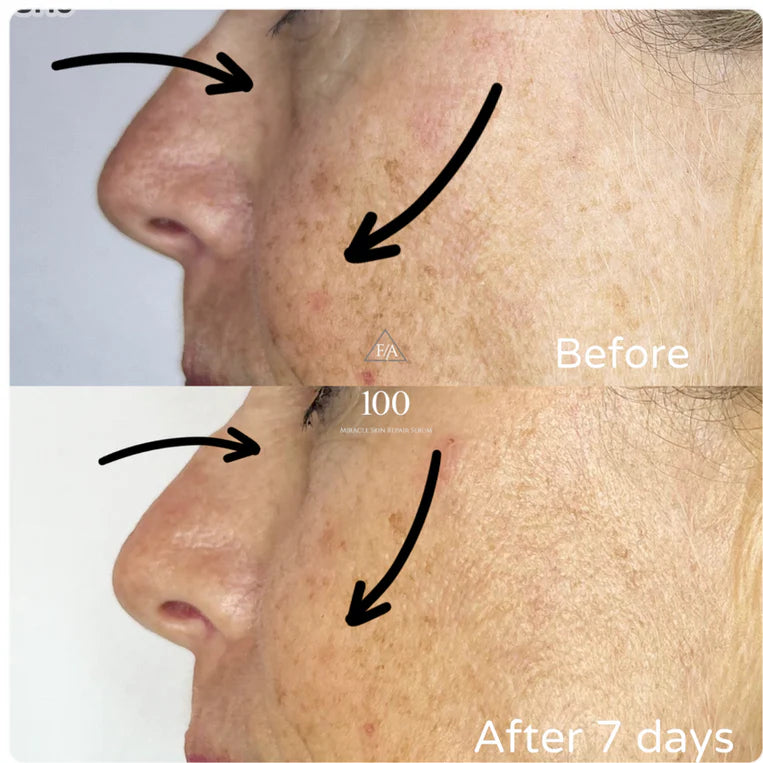 F/A 100 - Miracle Skin Repair Serum