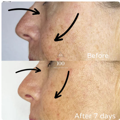 F/A 100 - Miracle Skin Repair Serum