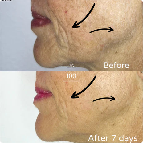 F/A 100 - Miracle Skin Repair Serum