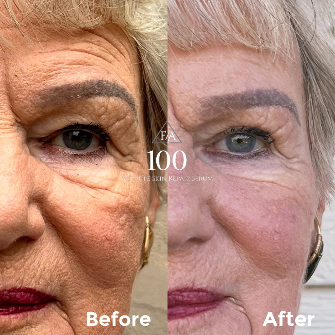 F/A 100 - Miracle Skin Repair Serum