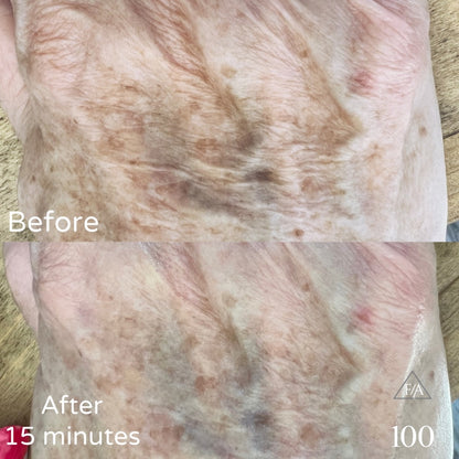 F/A 100 - Miracle Skin Repair Serum image 8