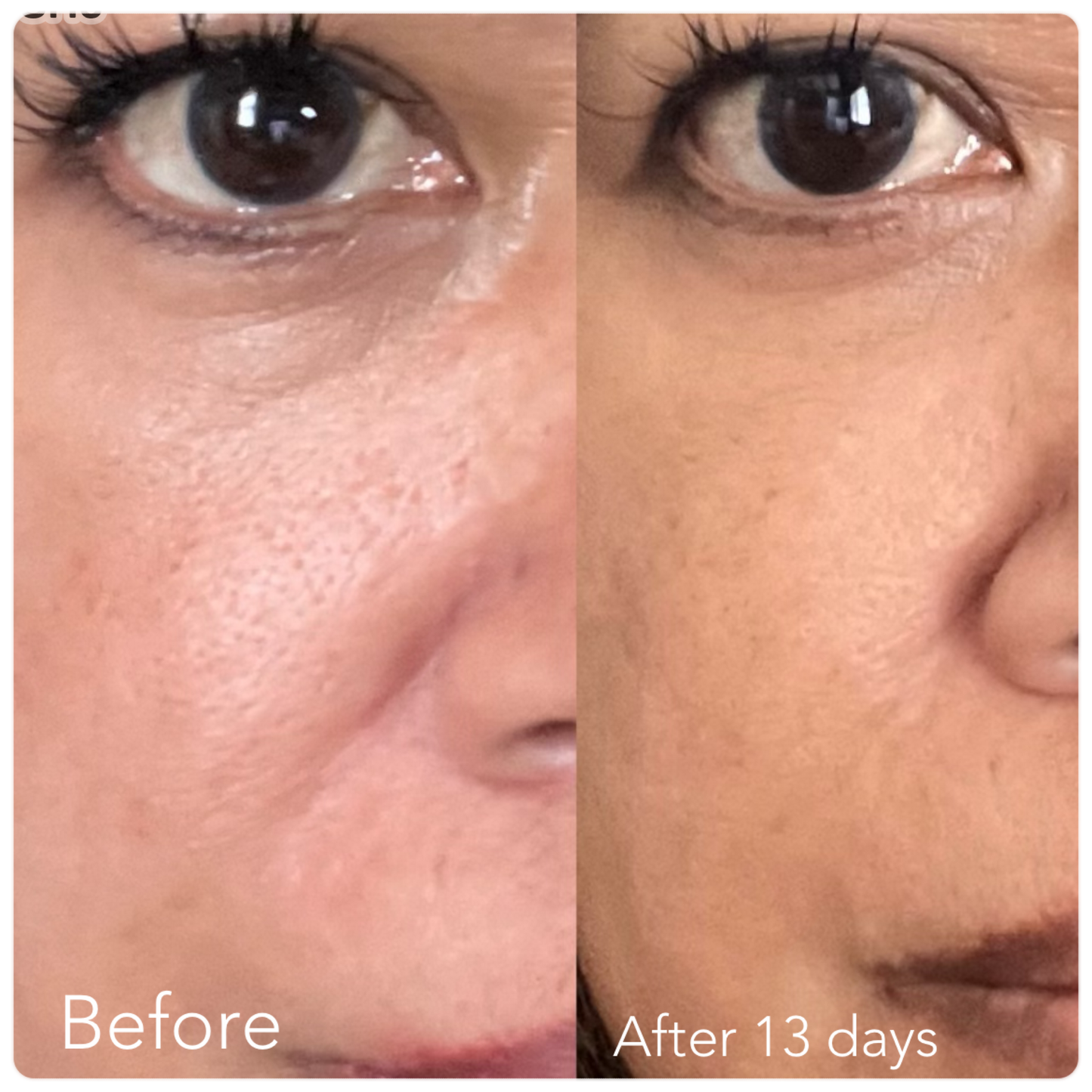 F/A 100 - Miracle Skin Repair Serum image 9