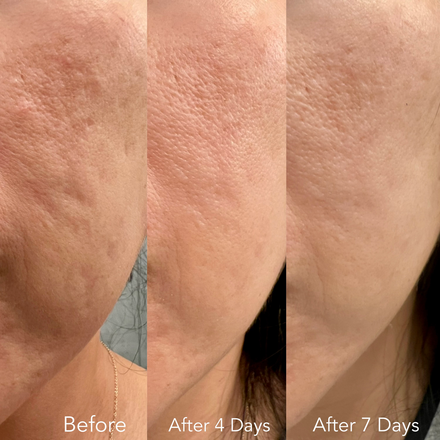 F/A 100 - Miracle Skin Repair Serum image 3