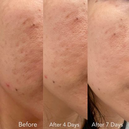 F/A 100 - Miracle Skin Repair Serum image 2