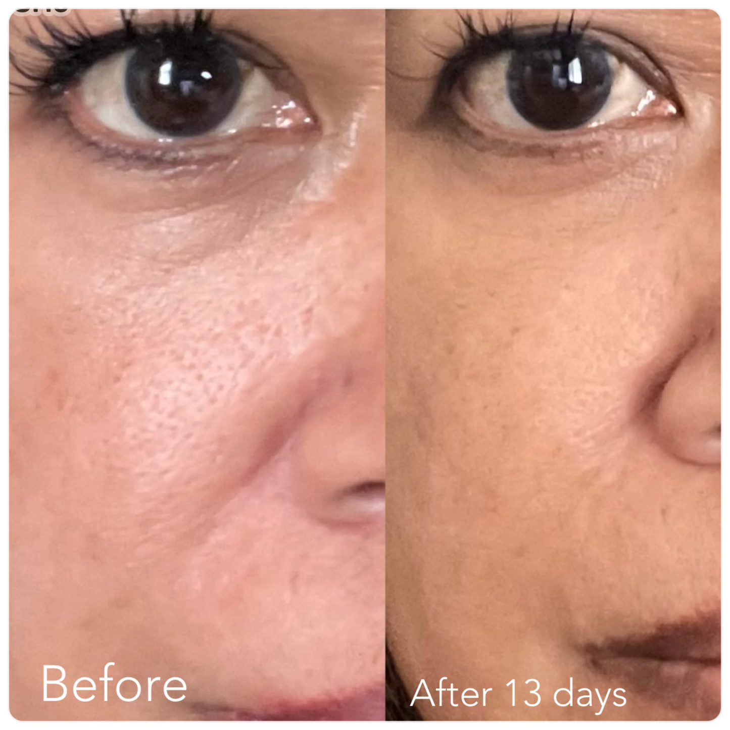 F/A 100 - Miracle Skin Repair Serum