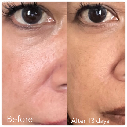 F/A 100 - Miracle Skin Repair Serum