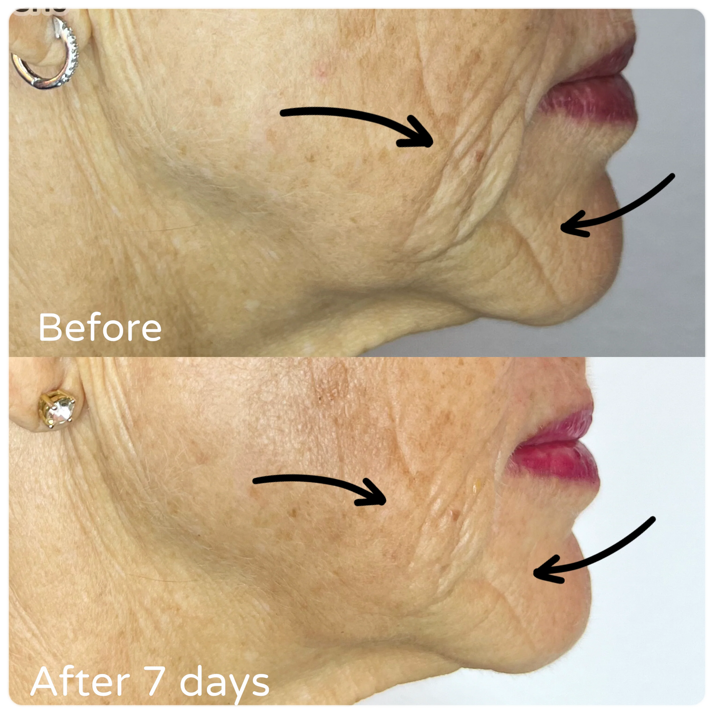 F/A 100 - Miracle Skin Repair Serum