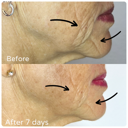 F/A 100 - Miracle Skin Repair Serum