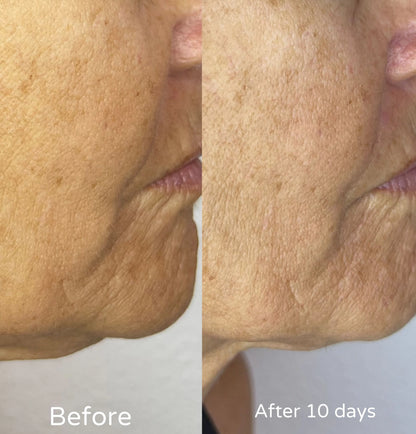 F/A 100 - Miracle Skin Repair Serum