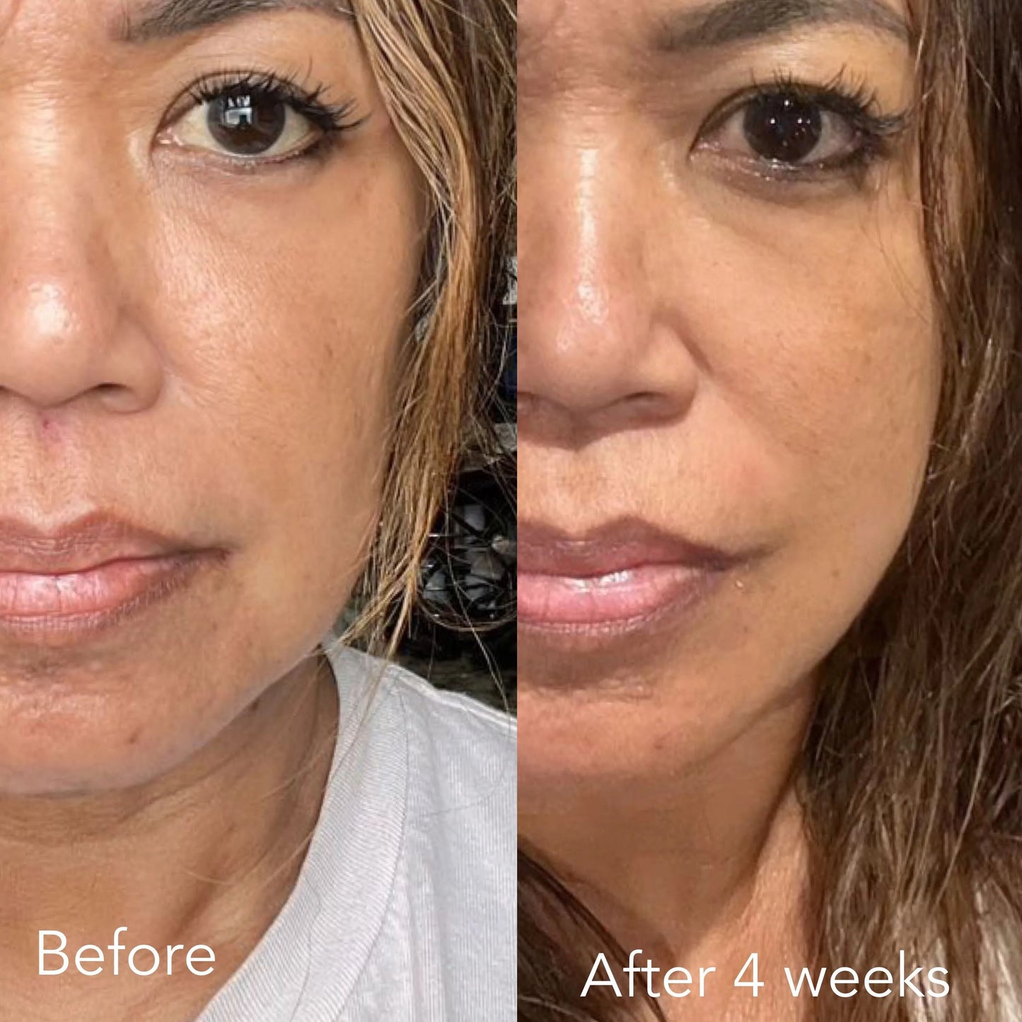 F/A 100 - Miracle Skin Repair Serum