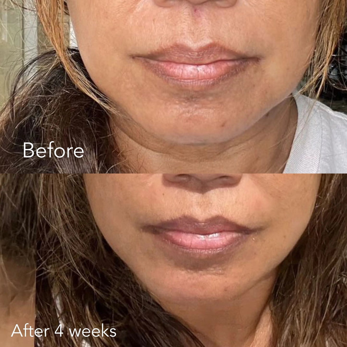 F/A 100 - Miracle Skin Repair Serum