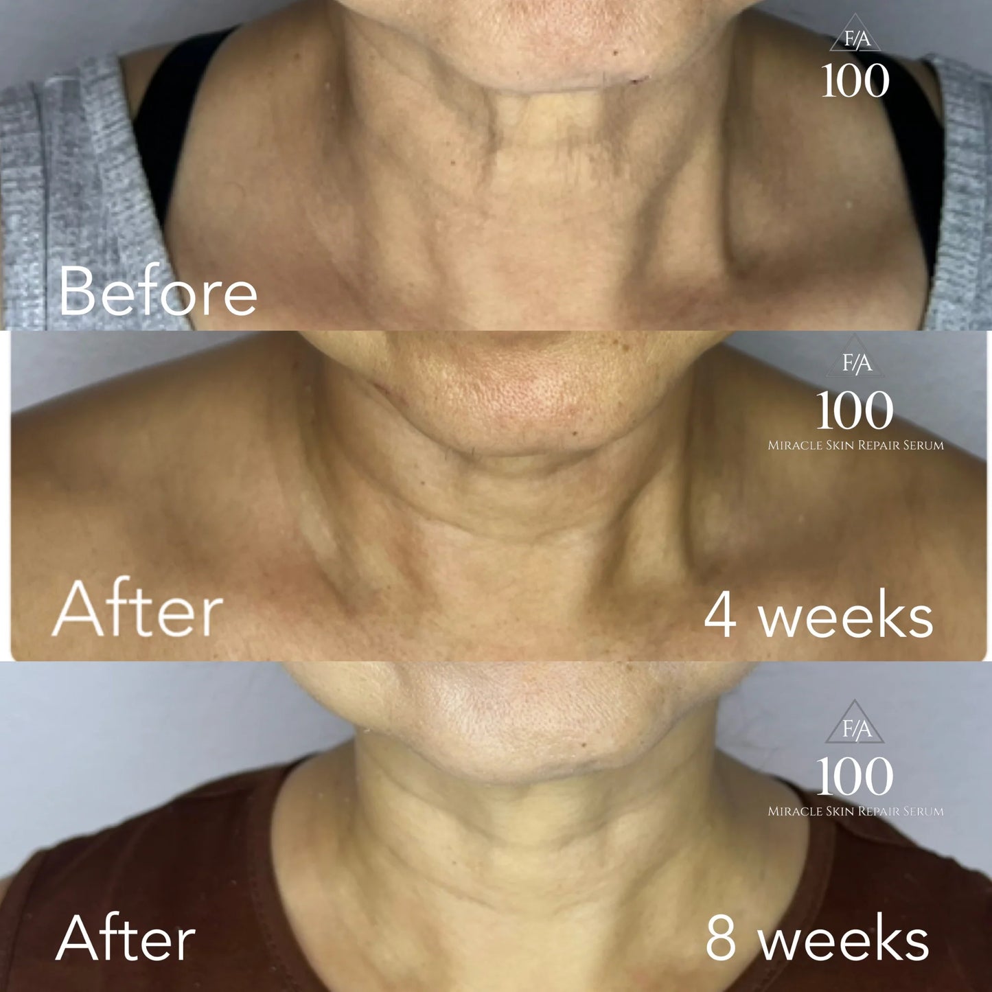 F/A 100 - Miracle Skin Repair Serum