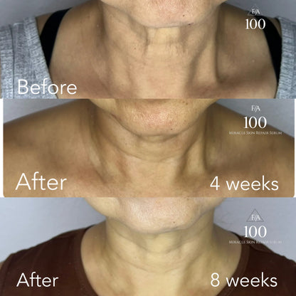 F/A 100 - Miracle Skin Repair Serum
