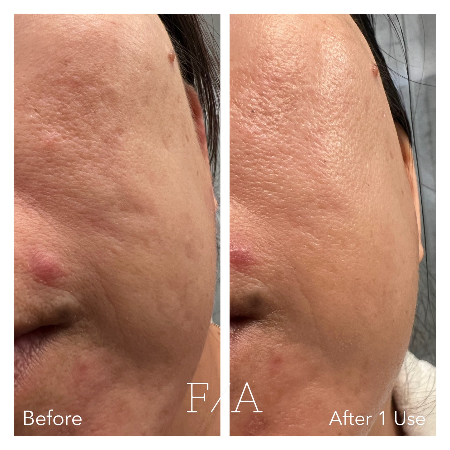 F/A 100 - Miracle Skin Repair Serum image 6